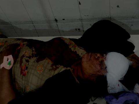 बराहक्षेत्रमा हात्तीको आक्रमण, दुई जना घाइते